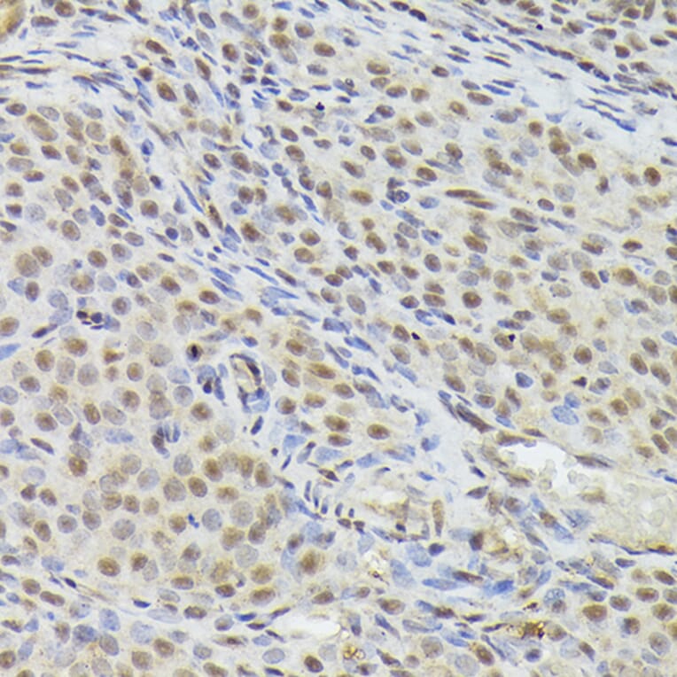 Immunohistochemistry - Anti-Nuclear Matrix Protein p84 Antibody (A16100) - Antibodies.com
