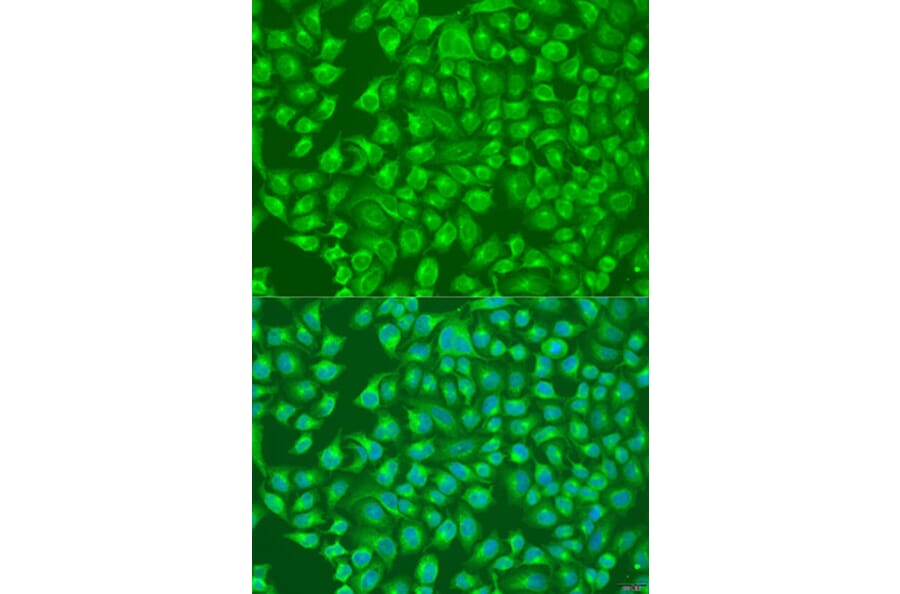 Immunofluorescence - Anti-SLC12A6 Antibody (A8180) - Antibodies.com