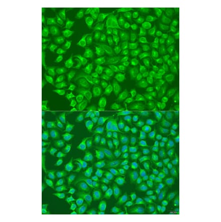 Immunofluorescence - Anti-SLC12A6 Antibody (A8180) - Antibodies.com