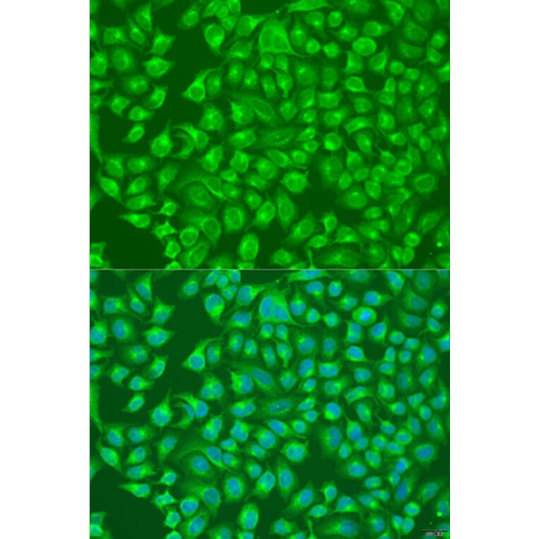 Immunofluorescence - Anti-SLC12A6 Antibody (A8180) - Antibodies.com