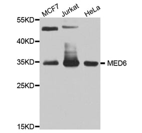 Western Blot - Anti-MED6 Antibody (A8181) - Antibodies.com