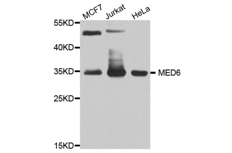 Western Blot - Anti-MED6 Antibody (A8181) - Antibodies.com