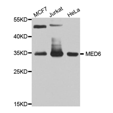 Western Blot - Anti-MED6 Antibody (A8181) - Antibodies.com