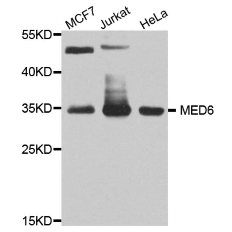 Western Blot - Anti-MED6 Antibody (A8181) - Antibodies.com
