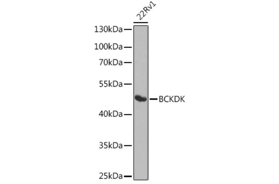 Western Blot - Anti-BCKDK Antibody (A16104) - Antibodies.com