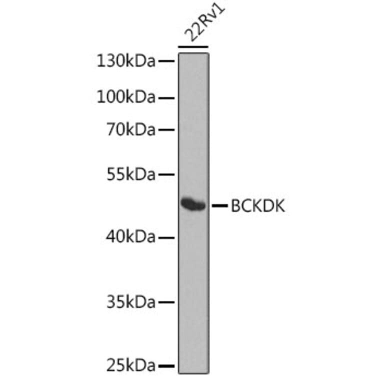 Western Blot - Anti-BCKDK Antibody (A16104) - Antibodies.com