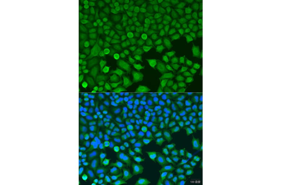 Immunofluorescence - Anti-BCKDK Antibody (A16104) - Antibodies.com