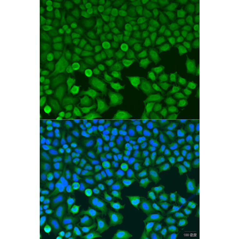 Immunofluorescence - Anti-BCKDK Antibody (A16104) - Antibodies.com