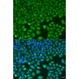 Immunofluorescence - Anti-BCKDK Antibody (A16104) - Antibodies.com
