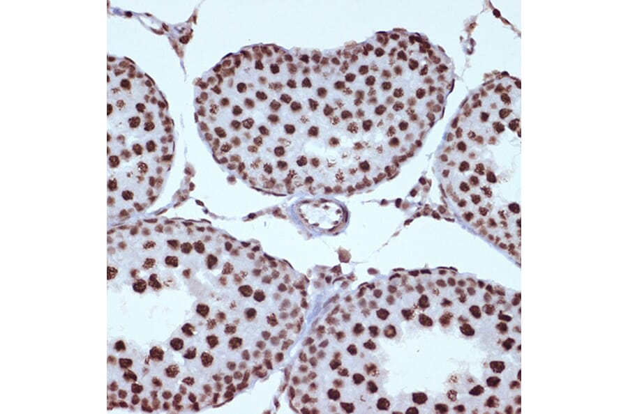 Immunohistochemistry - Anti-ILF3 Antibody [ARC1438] (A16105) - Antibodies.com