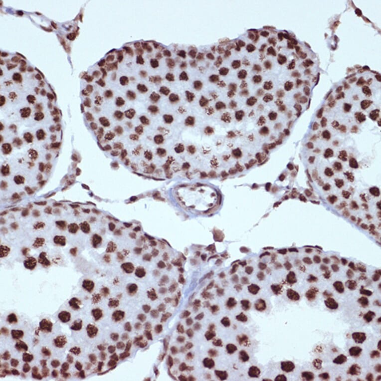 Immunohistochemistry - Anti-ILF3 Antibody [ARC1438] (A16105) - Antibodies.com