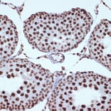 Immunohistochemistry - Anti-ILF3 Antibody [ARC1438] (A16105) - Antibodies.com