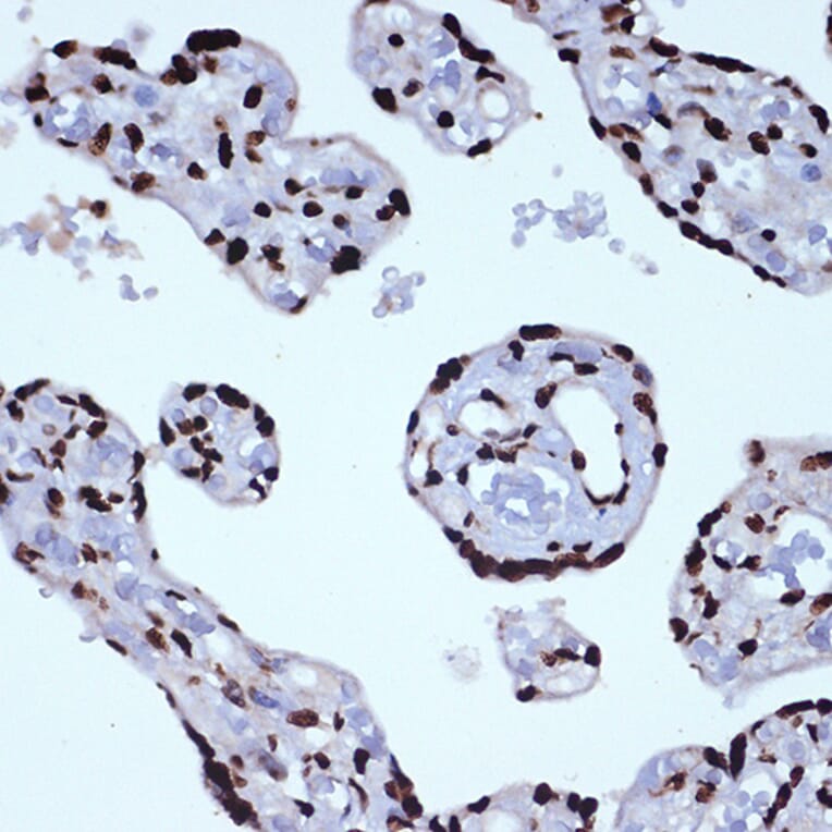 Immunohistochemistry - Anti-ILF3 Antibody [ARC1438] (A16105) - Antibodies.com