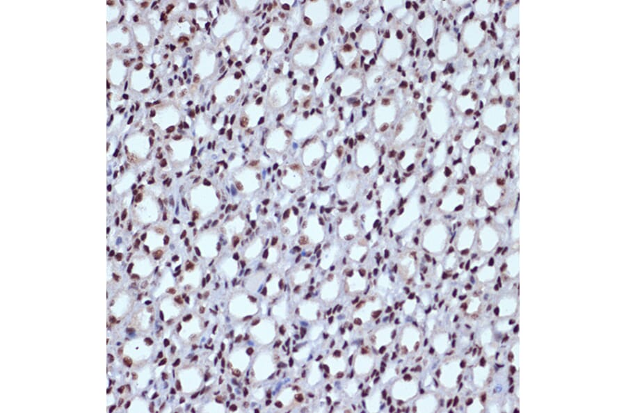 Immunohistochemistry - Anti-ILF3 Antibody [ARC1438] (A16105) - Antibodies.com