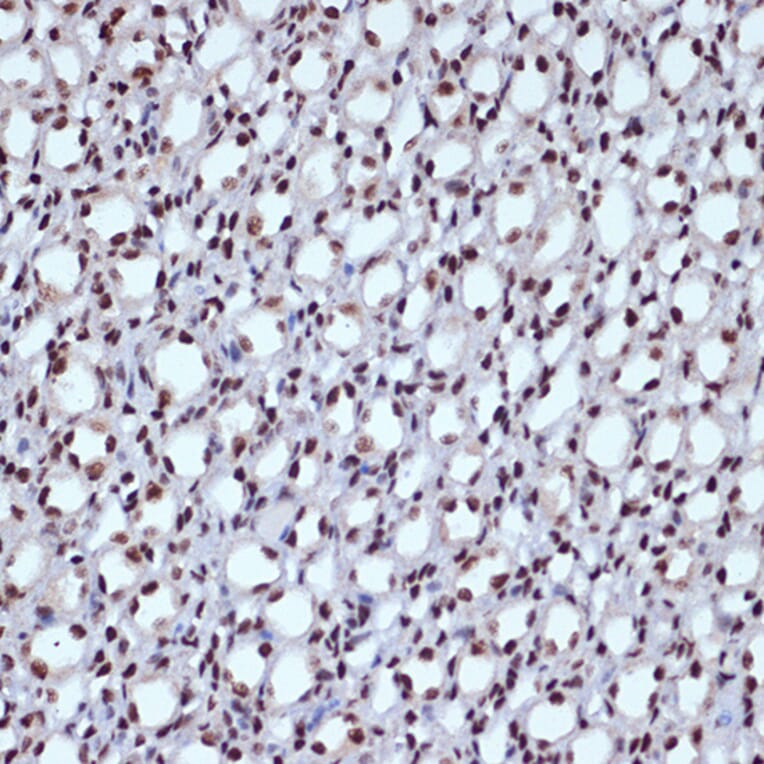 Immunohistochemistry - Anti-ILF3 Antibody [ARC1438] (A16105) - Antibodies.com