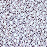 Immunohistochemistry - Anti-ILF3 Antibody [ARC1438] (A16105) - Antibodies.com