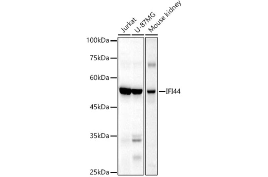 Western Blot - Anti-IFI44 Antibody (A16106) - Antibodies.com