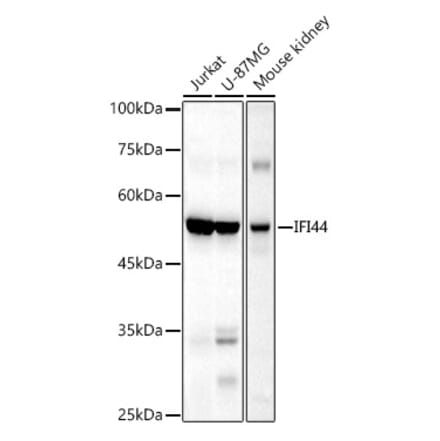 Western Blot - Anti-IFI44 Antibody (A16106) - Antibodies.com