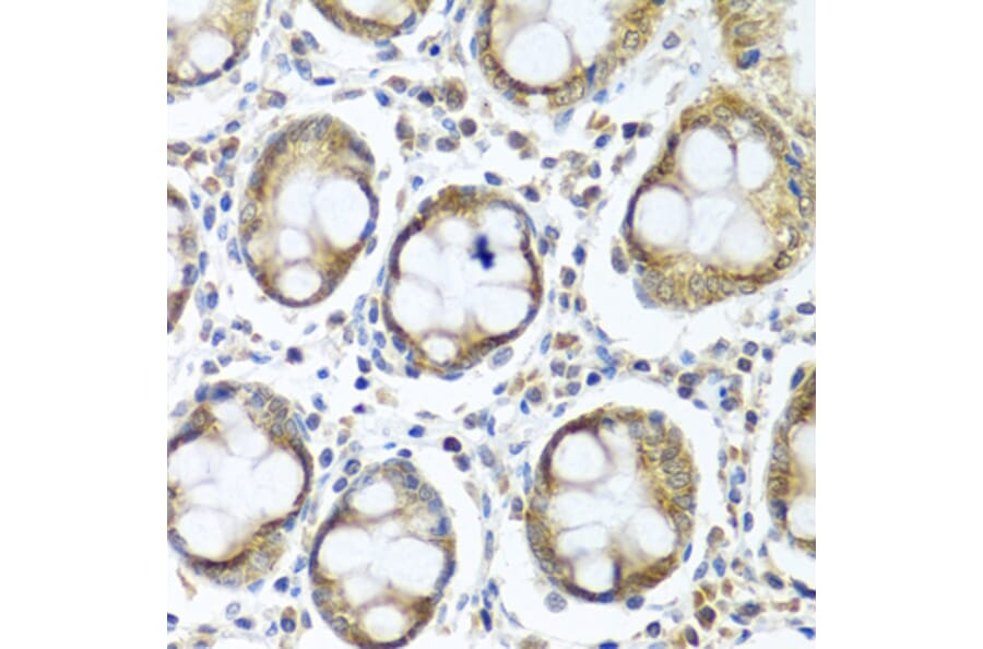 Immunohistochemistry - Anti-IFI44 Antibody (A16106) - Antibodies.com