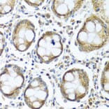 Immunohistochemistry - Anti-IFI44 Antibody (A16106) - Antibodies.com