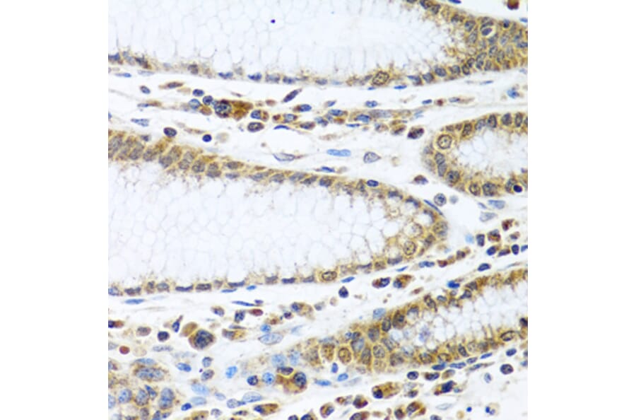 Immunohistochemistry - Anti-IFI44 Antibody (A16106) - Antibodies.com
