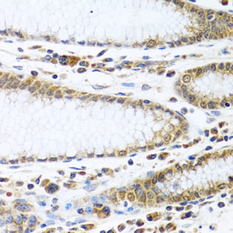 Immunohistochemistry - Anti-IFI44 Antibody (A16106) - Antibodies.com