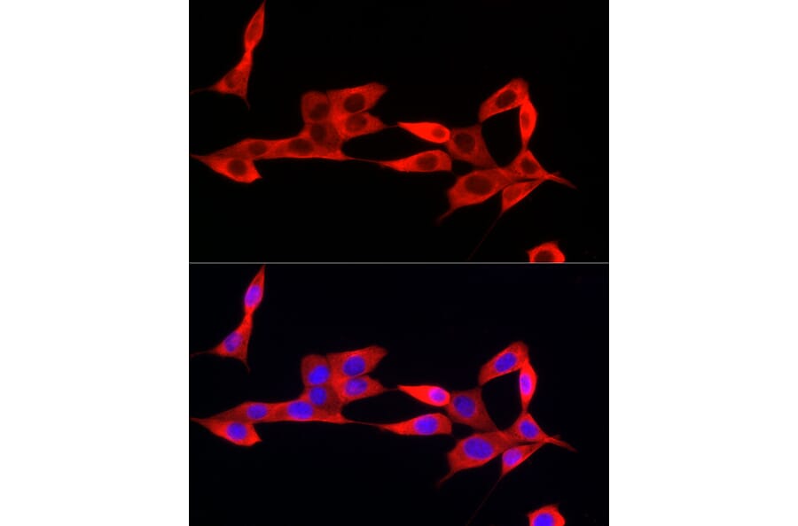 Immunofluorescence - Anti-IFI44 Antibody (A16106) - Antibodies.com