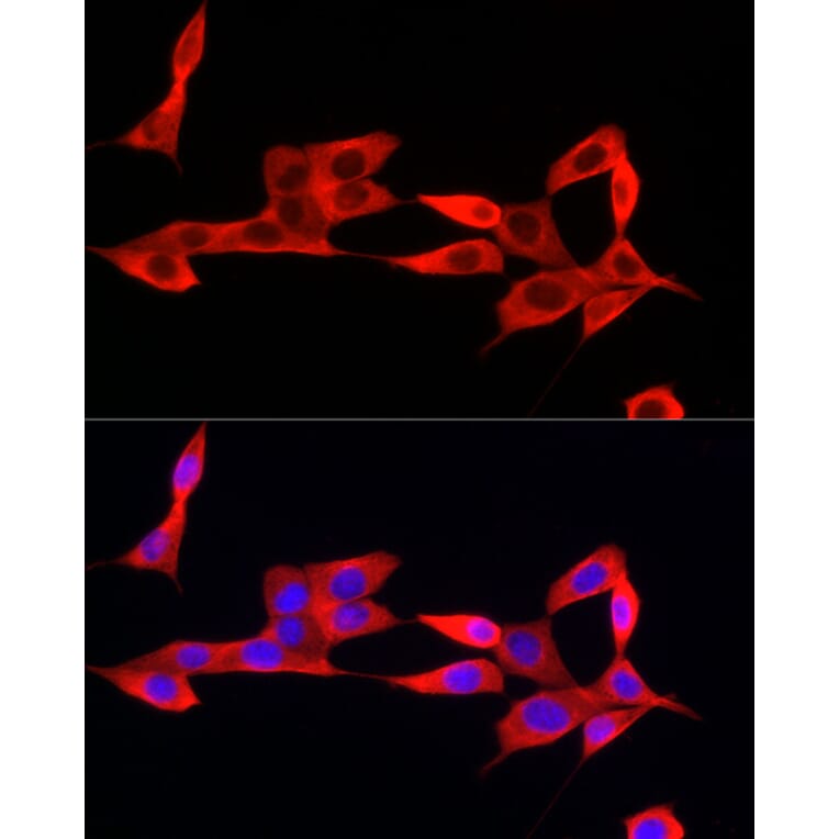 Immunofluorescence - Anti-IFI44 Antibody (A16106) - Antibodies.com