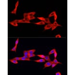 Immunofluorescence - Anti-IFI44 Antibody (A16106) - Antibodies.com