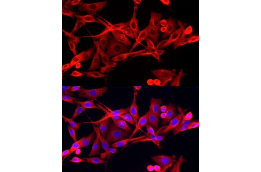 Immunofluorescence - Anti-IFI44 Antibody (A16106) - Antibodies.com