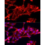 Immunofluorescence - Anti-IFI44 Antibody (A16106) - Antibodies.com