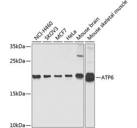 Western Blot - Anti-MT-ATP6 Antibody (A16108) - Antibodies.com