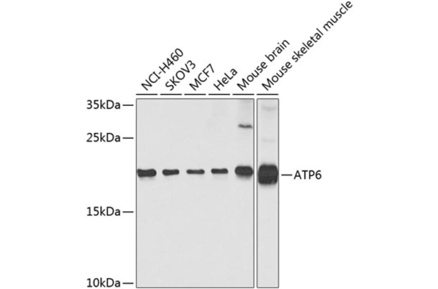 Western Blot - Anti-MT-ATP6 Antibody (A16108) - Antibodies.com