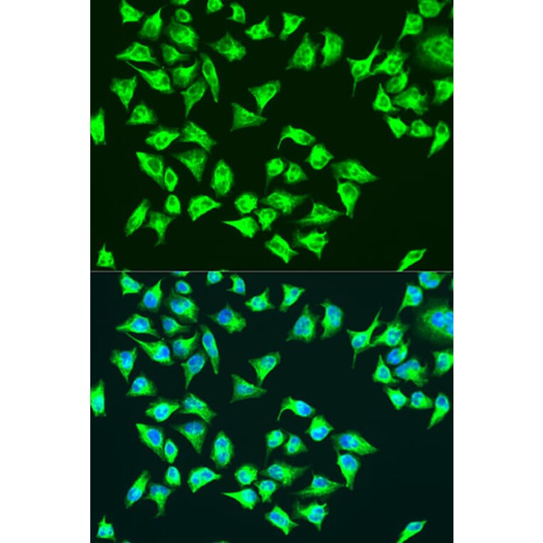 Immunofluorescence - Anti-MT-ATP6 Antibody (A16108) - Antibodies.com