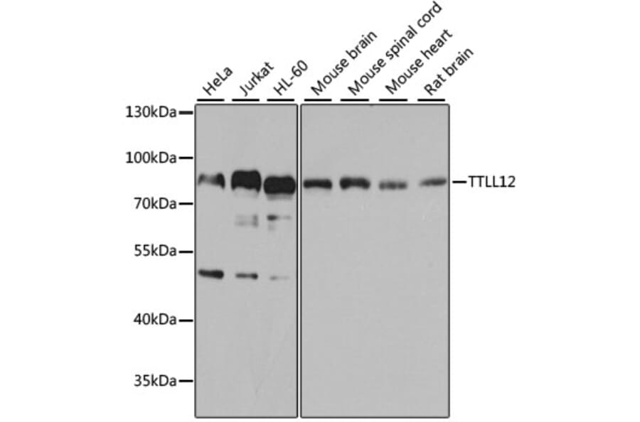Western Blot - Anti-TTLL12 Antibody (A8197) - Antibodies.com