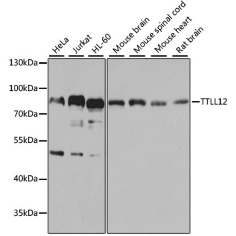 Western Blot - Anti-TTLL12 Antibody (A8197) - Antibodies.com