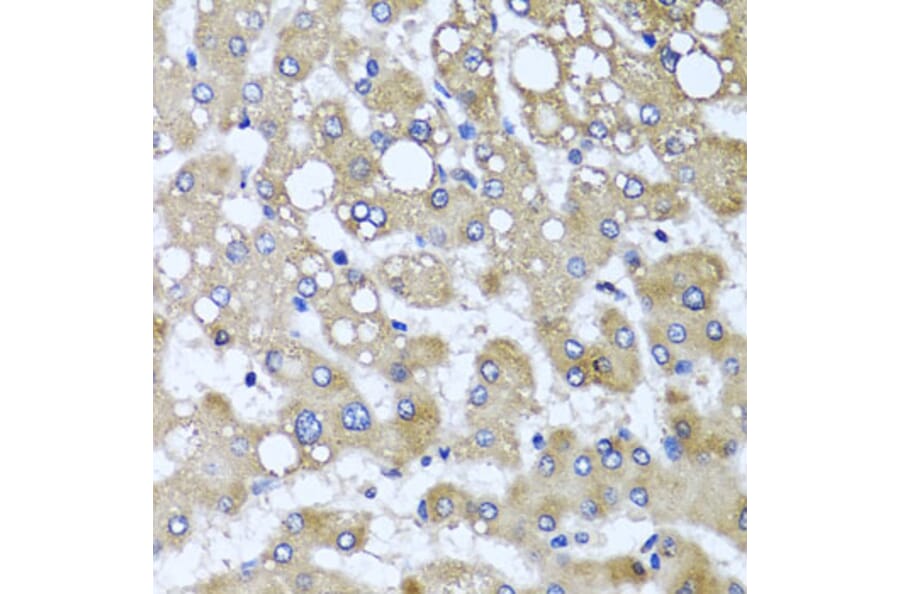 Immunohistochemistry - Anti-TTLL12 Antibody (A8197) - Antibodies.com