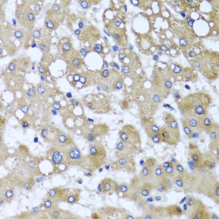Immunohistochemistry - Anti-TTLL12 Antibody (A8197) - Antibodies.com