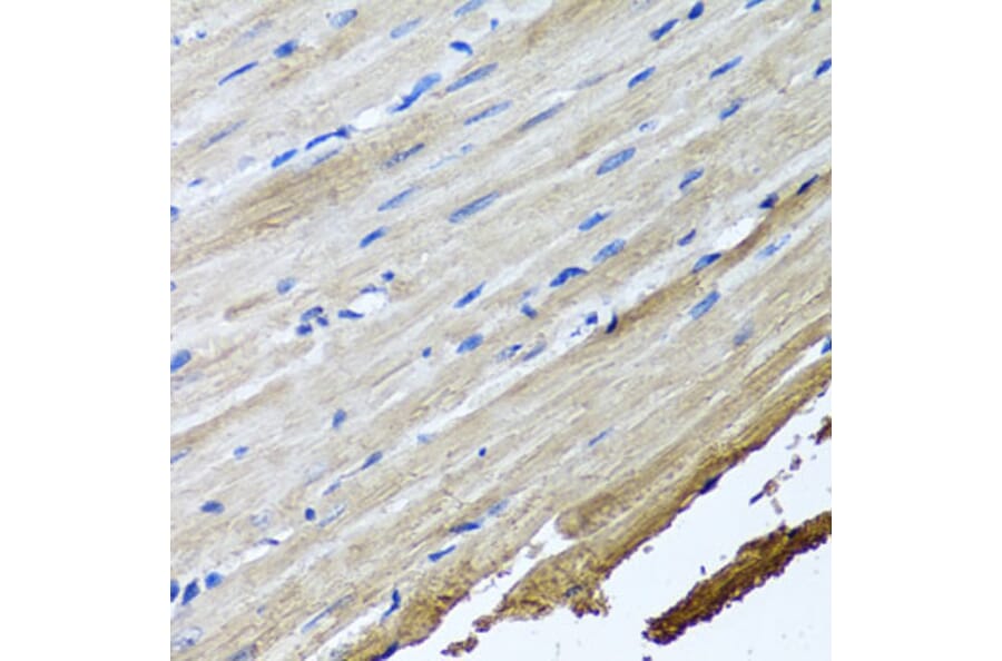 Immunohistochemistry - Anti-TTLL12 Antibody (A8197) - Antibodies.com