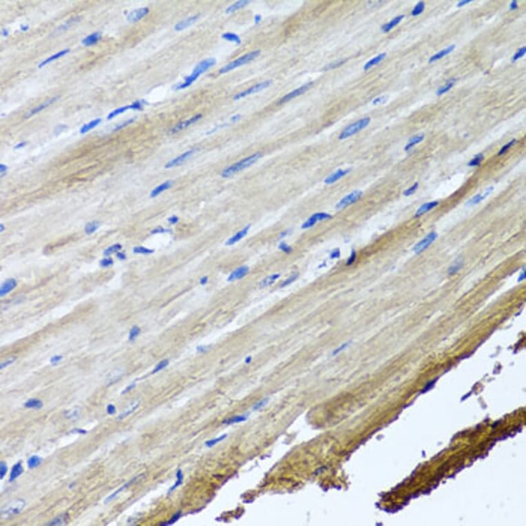 Immunohistochemistry - Anti-TTLL12 Antibody (A8197) - Antibodies.com