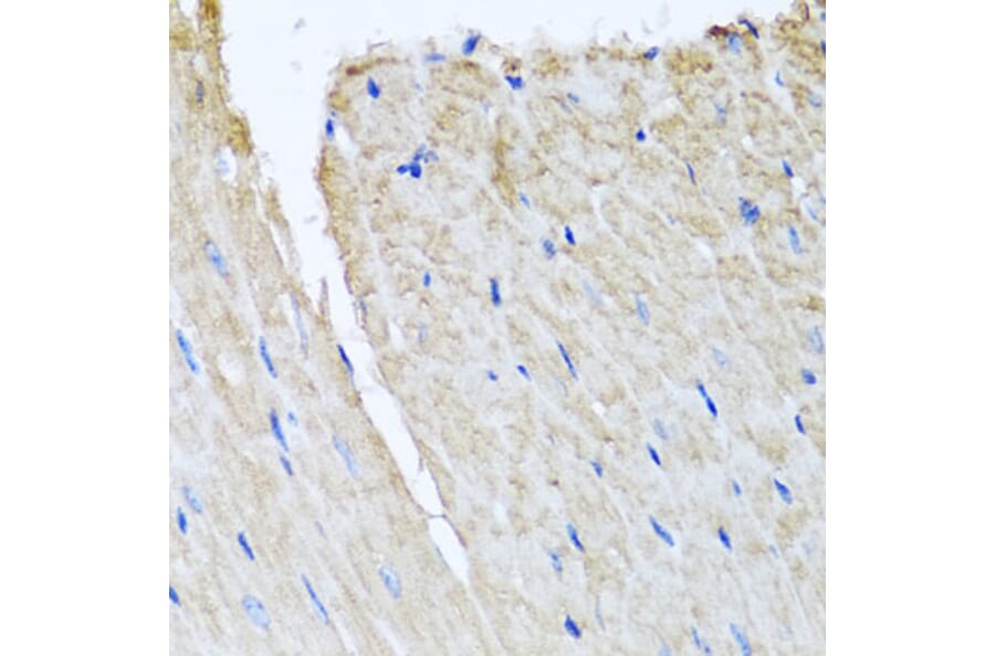 Immunohistochemistry - Anti-TTLL12 Antibody (A8197) - Antibodies.com