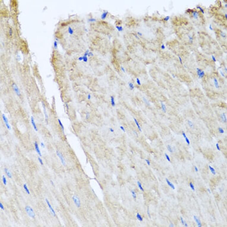 Immunohistochemistry - Anti-TTLL12 Antibody (A8197) - Antibodies.com