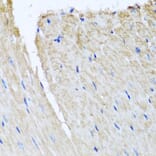 Immunohistochemistry - Anti-TTLL12 Antibody (A8197) - Antibodies.com