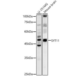 Western Blot - Anti-SYT11 Antibody (A16111) - Antibodies.com