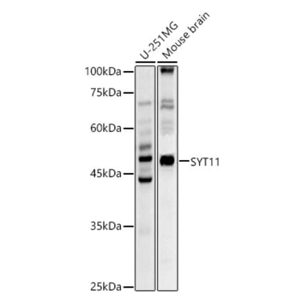 Western Blot - Anti-SYT11 Antibody (A16111) - Antibodies.com