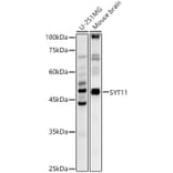Western Blot - Anti-SYT11 Antibody (A16111) - Antibodies.com