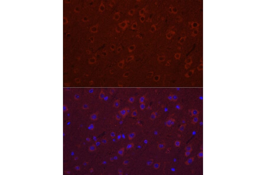 Immunofluorescence - Anti-SYT11 Antibody (A16111) - Antibodies.com