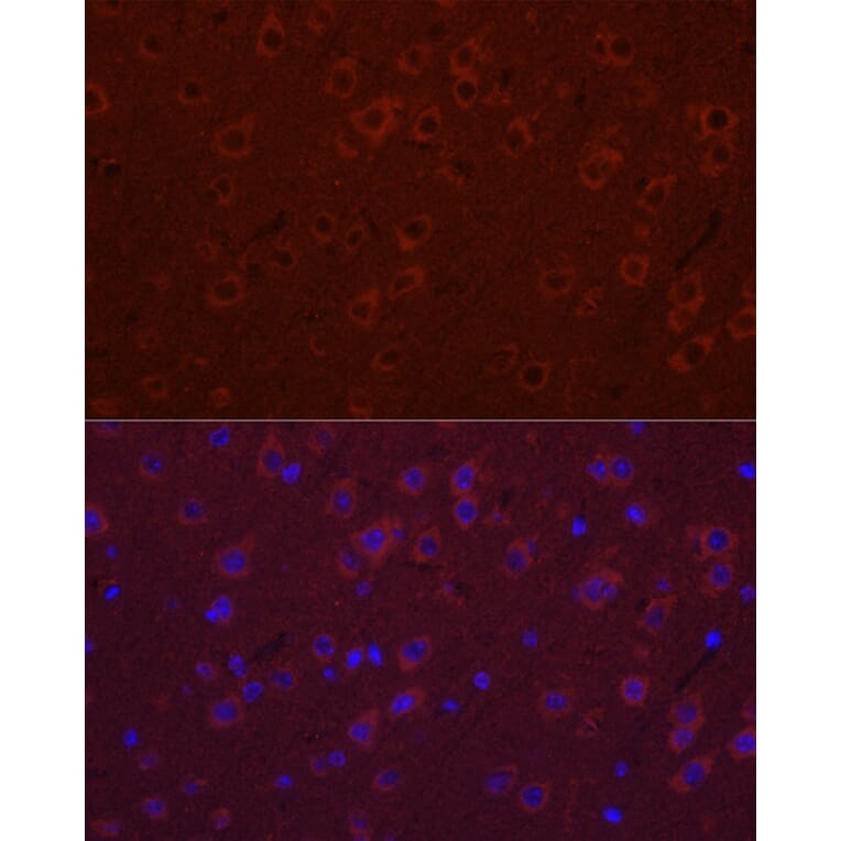 Immunofluorescence - Anti-SYT11 Antibody (A16111) - Antibodies.com