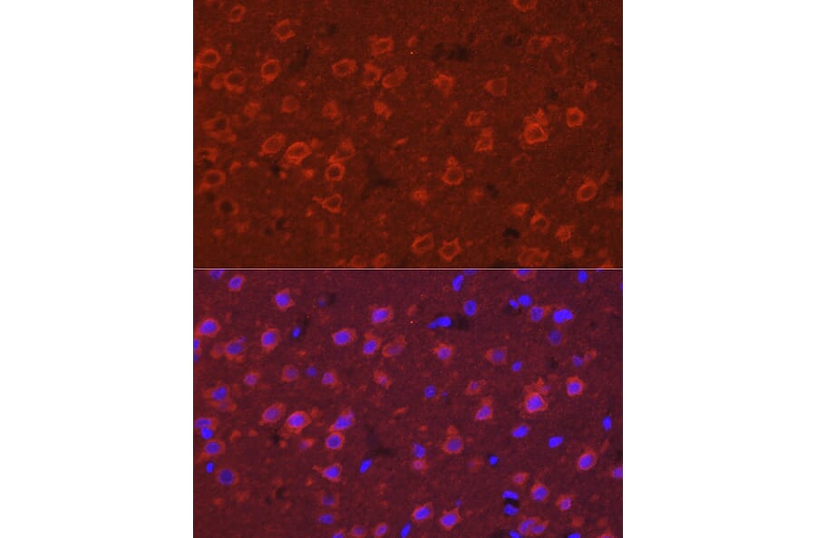 Immunofluorescence - Anti-SYT11 Antibody (A16111) - Antibodies.com