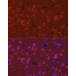 Immunofluorescence - Anti-SYT11 Antibody (A16111) - Antibodies.com